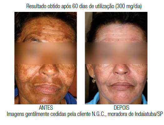 antes-depois-ali-ola